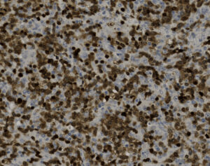 Tissue-Tek Genie<sup>&reg;</sup> anti-ZAP70