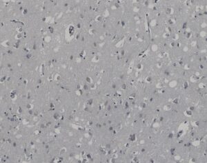 Tissue-Tek Genie<sup>&reg;</sup> DUO Non-immune Mouse and Rabbit Ig Antibody Cocktail, Negative Control