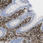 Microscopic image of tissue section showing brown-stained cells among blue-stained cells, indicating regions of protein expression in a histological sample.
