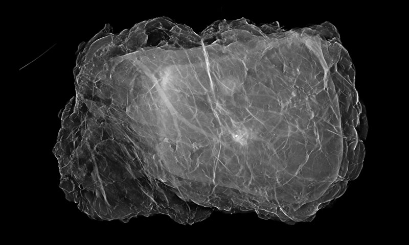 X-ray image
