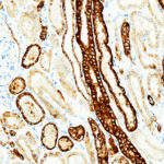 Tissue-Tek Genie<sup>&reg;</sup> anti-Epithelial Cell Adhesion Molecule