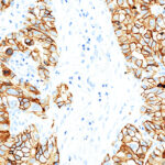 Tissue-Tek Genie<sup>&reg;</sup> anti-Epithelial Cell Adhesion Molecule