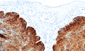 Tissue-Tek Genie&reg; anti-Epithelial Cell Adhesion Molecule
