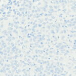 Tissue-Tek Genie<sup>&reg;</sup> anti-INSM1