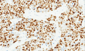Tissue-Tek Genie&reg; anti-INSM1