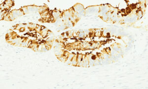 Tissue-Tek Genie&reg; anti-MUC5AC