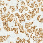 Tissue-Tek Genie<sup>&reg;</sup> anti-SALL4