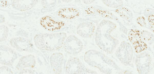 Tissue-Tek Genie&reg; anti-SALL4