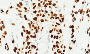 Tissue-Tek Genie&reg; anti-TRPS1