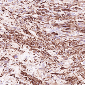 Tissue-Tek Genie&reg; anti-Caldesmon