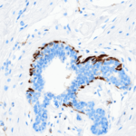 Tissue-Tek Genie® anti-Caldesmon - Additional Image 1