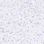 Tissue-Tek Genie® anti-Caldesmon - Additional Image 3