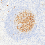 Tissue-Tek Genie® anti-CD10 [QR021] - Additional Image 1