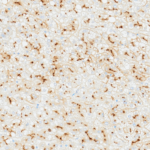 Tissue-Tek Genie® anti-CD10 [QR021] - Additional Image 2