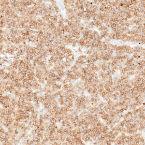 Tissue-Tek Genie&reg; anti-CD10 [QR021]