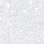 Tissue-Tek Genie® anti-CD10 [QR021] - Additional Image 3