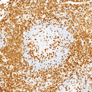 Tissue-Tek Genie&reg; anti-CD3 [EP177]