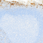 Tissue-Tek Genie® anti-Cytokeratin 18 - Additional Image 1