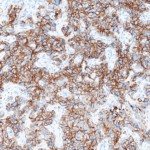 Tissue-Tek Genie® anti-Cytokeratin 18 - Additional Image 2