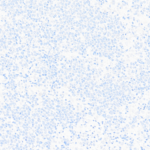 Tissue-Tek Genie® anti-Cytokeratin 18 - Additional Image 3