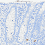 Tissue-Tek Genie® anti-Cytokeratin 7 - Additional Image 2