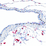 Tissue-Tek Genie® DUO anti-p40 / Napsin A Antibody Cocktail - Additional Image 1