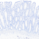 Tissue-Tek Genie® DUO anti-p40 / Napsin A Antibody Cocktail - Additional Image 2