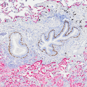 Tissue-Tek Genie&reg; DUO anti-p40 / Napsin A Antibody Cocktail