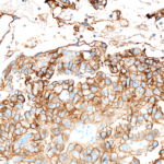 Tissue-Tek Genie® anti-Glypican-3 - Additional Image 1
