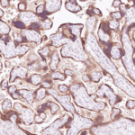 Tissue-Tek Genie® anti-Glypican-3 - Additional Image 2