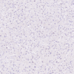 Tissue-Tek Genie® anti-Glypican-3 - Additional Image 3
