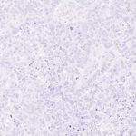 Tissue-Tek Genie® anti-Glypican-3 - Additional Image 4