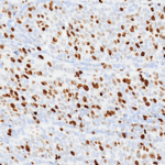 Tissue-Tek Genie® anti-Ki67 [GM027] - Additional Image 2