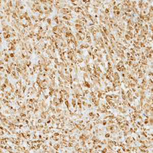 Tissue-Tek Genie&reg; anti-Melan-A
