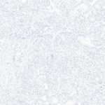 Tissue-Tek Genie® anti-Melan-A - Additional Image 3