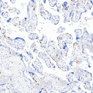Tissue-Tek Genie&reg; anti-p40