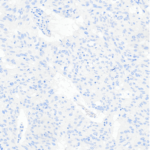 Tissue-Tek Genie® anti-p40 - Additional Image 3