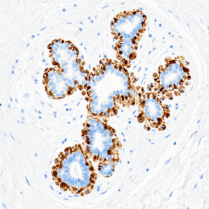 Tissue-Tek Genie&reg; anti-p40 / Myosin Smooth Muscle Antibody Cocktail