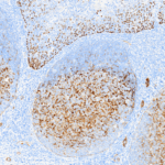 Tissue-Tek Genie® anti-p40 / Myosin Smooth Muscle Antibody Cocktail - Additional Image 1