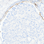 Tissue-Tek Genie® anti-p40 / Myosin Smooth Muscle Antibody Cocktail - Additional Image 2