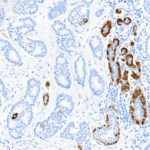 Tissue-Tek Genie® anti-p40 / Myosin Smooth Muscle Antibody Cocktail - Additional Image 3