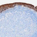 Tissue-Tek Genie® anti-Cytokeratin Pan Antibody Cocktail [AE1/AE3/DC10] - Additional Image 1