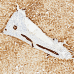 Tissue-Tek Genie® anti-Cytokeratin Pan Antibody Cocktail [AE1/AE3/DC10] - Additional Image 2