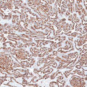 Tissue-Tek Genie&reg; anti-Cytokeratin Pan Antibody Cocktail [AE1/AE3/DC10]