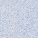 Tissue-Tek Genie® anti-Cytokeratin Pan Antibody Cocktail [AE1/AE3/DC10] - Additional Image 3