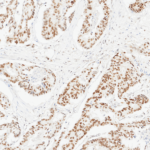 Tissue-Tek Genie® anti-PMS2 - Additional Image 2