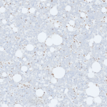 Tissue-Tek Genie® anti-PMS2 - Additional Image 3