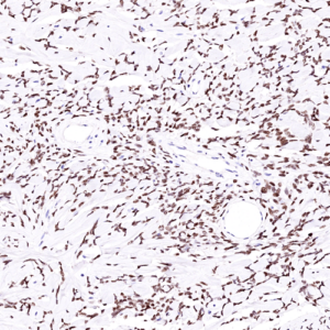 Tissue-Tek Genie&reg; anti-STAT6