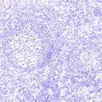 Tissue-Tek Genie® anti-STAT6 - Additional Image 1