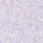 Tissue-Tek Genie® anti-STAT6 - Additional Image 2